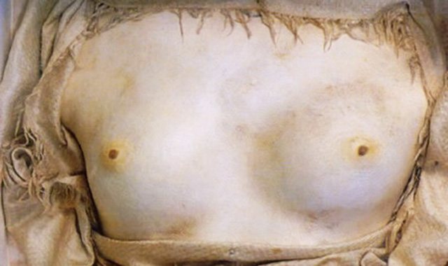 Girolamo Segato: El que convertía los cuerpos en piedra